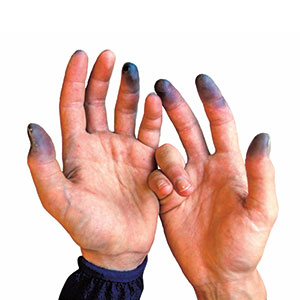 a pair of hands with black fingers